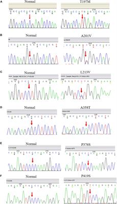 Detection of Rare Methyl-CpG Binding Protein 2 Gene Missense Mutations in Patients With Schizophrenia